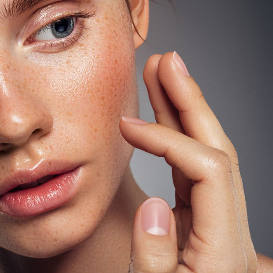 Huid met aanleg voor hyperpigmentatie